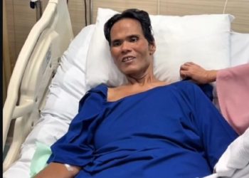 Fahmi Bo Siap Jalani Operasi Batu Empedu Terbaru